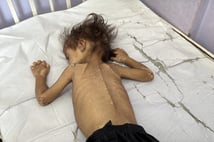 Gazze Şeridi'nde son 24 saatte 2 kişi açlıktan hayatını kaybetti