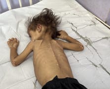 Gazze Şeridi'nde son 24 saatte 2 kişi açlıktan hayatını kaybetti