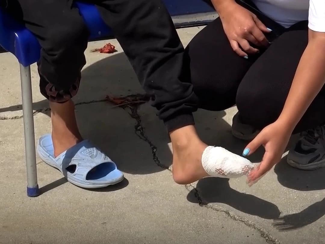 Başıboş köpeklerin saldırısında yaralandı