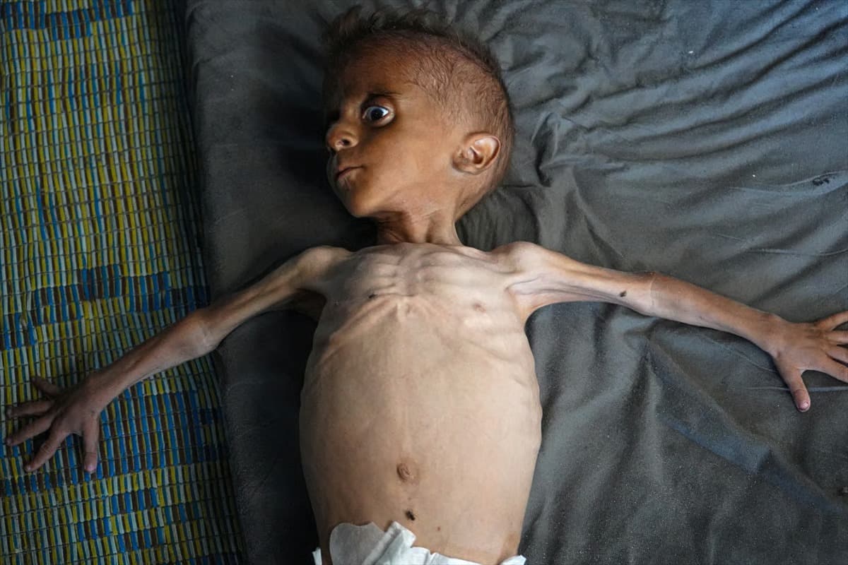 Gazze'de son 24 saatte 1'i çocuk 7 kişi açlıktan öldü
