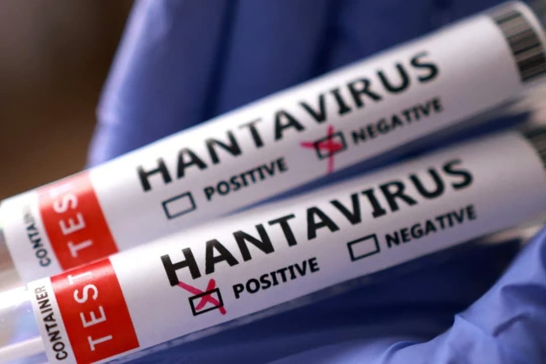 DSÖ’den Hantavirüs ile ilgili kritik açıklama