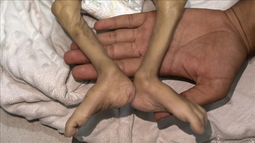 Son 24 saatte 6 Gazzeli açlıktan öldü