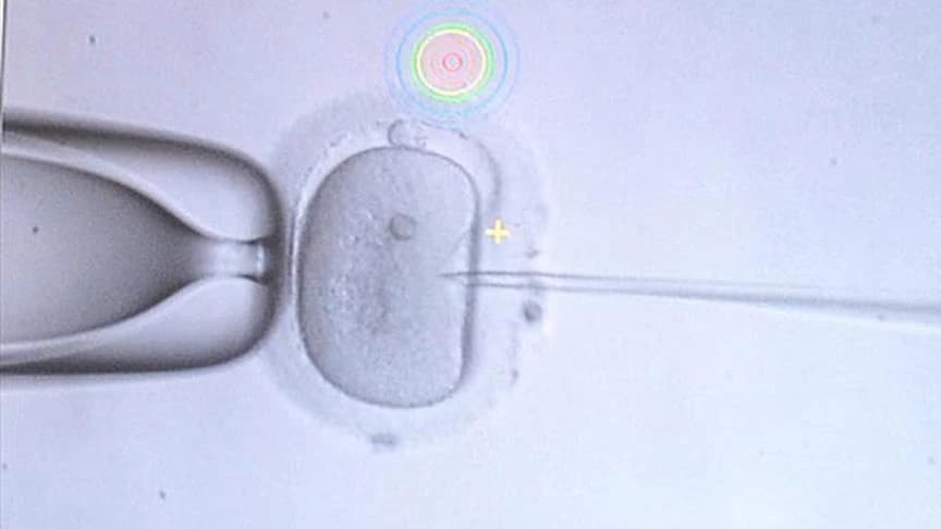 Sperm bağışı
