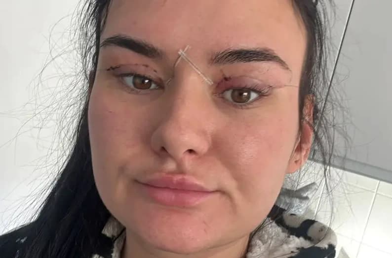 Ucuz gözkapağı ameliyatı riskleri
