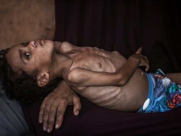 Gazze’de 24 saatte 10 kişi açlıktan hayatını kaybetti