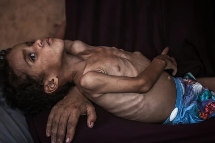 Gazze’de 24 saatte 10 kişi açlıktan hayatını kaybetti