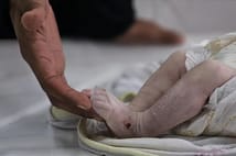 Gazze Şeridi'nde son 24 saatte 6 kişi açlıktan hayatını kaybetti