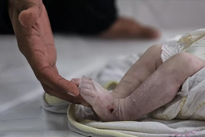 Gazze Şeridi'nde son 24 saatte 6 kişi açlıktan hayatını kaybetti