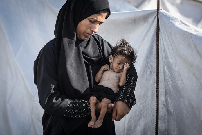 Gazze'de açlıktan ölenlerin sayısı 201'e ulaştı