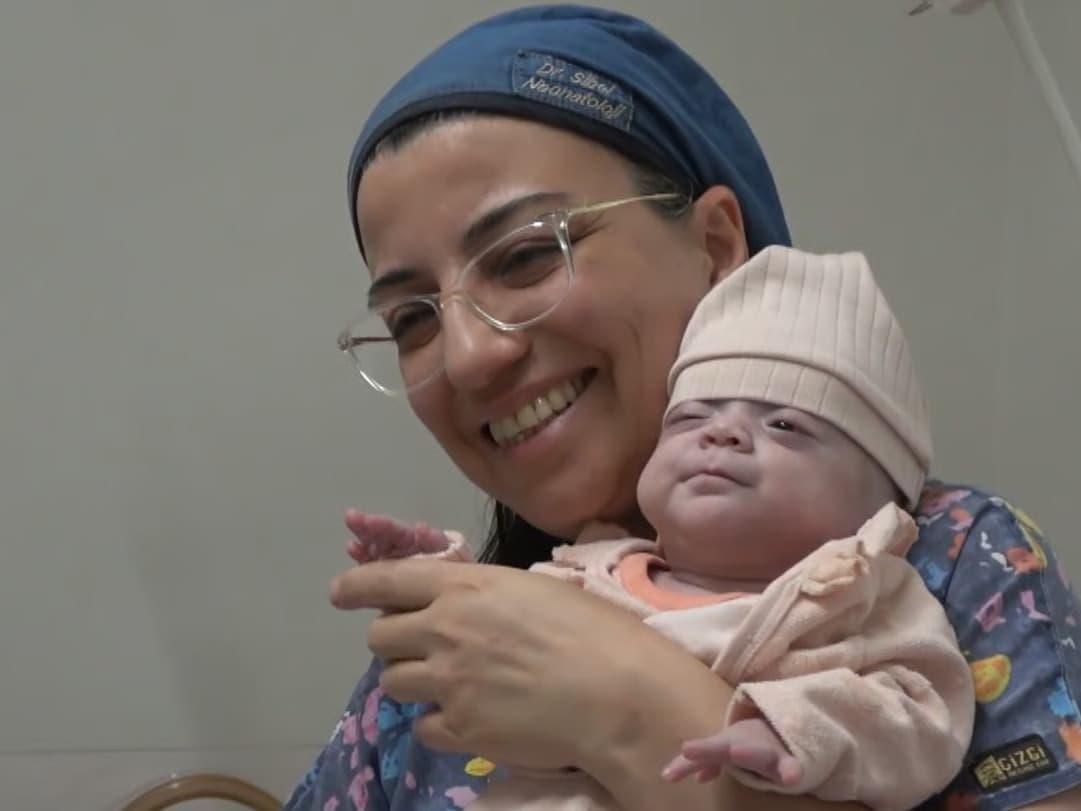 780 gram doğan Elfin bebeğin 180 günlük yaşam mücadelesi