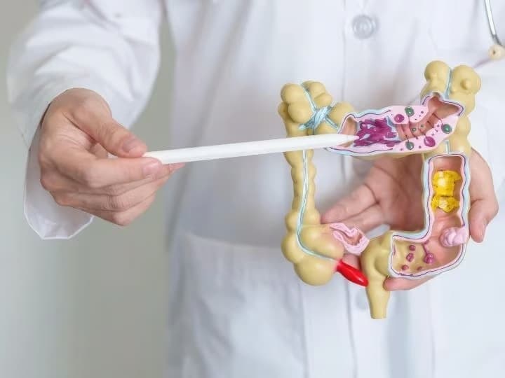 Probiyotik kullanırken dikkat: Yarardan çok zararı olabilir