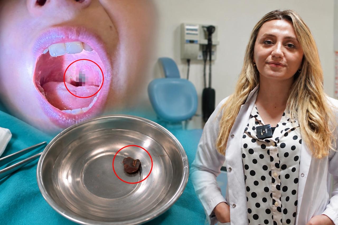 10 yaşındaki çocuğun burnu sürekli kanıyordu! Sebebi bambaşka çıktı: Boğazından canlı çıktı