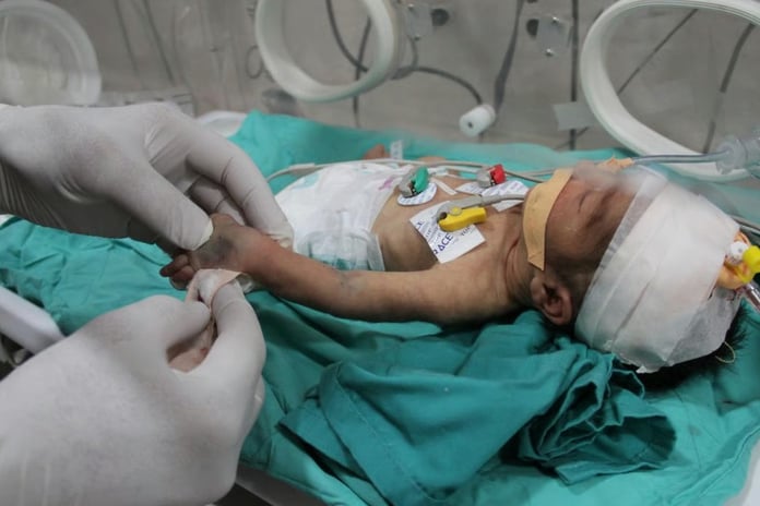 Gazzeli bebekler için son çağrı: 48 saat içinde ölümler başlayabilir