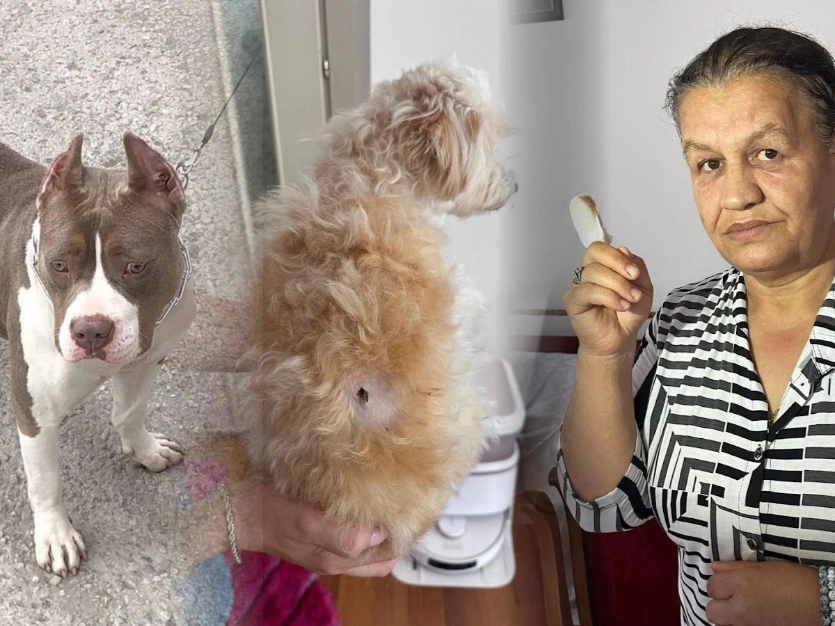 Pitbull saldırısına uğrayan kadının parmağı koptu