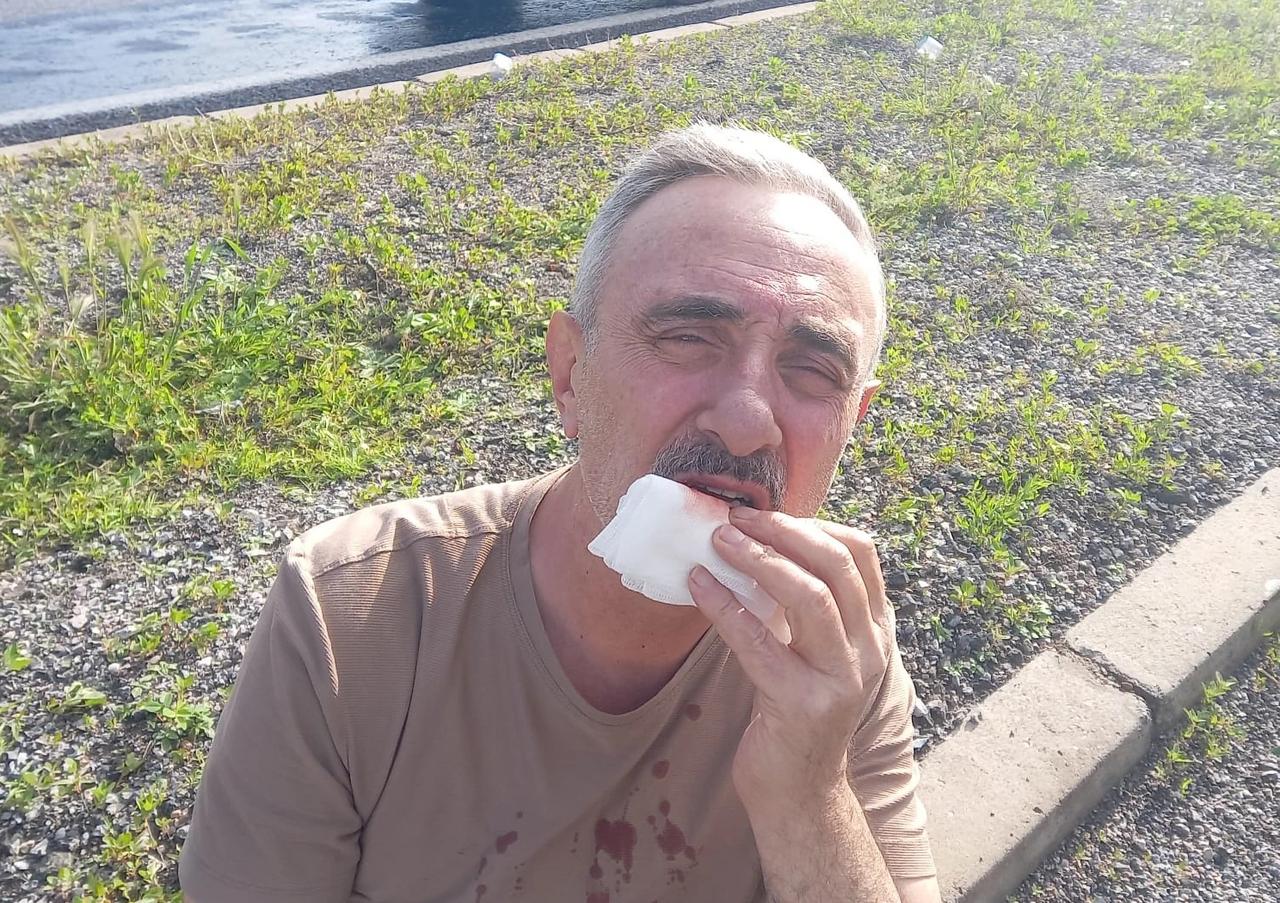 Kapadokya yolunda korkutan kaza: Çok sayıda yaralı var! 