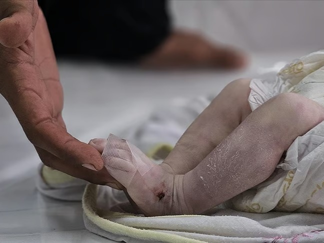 Gazze'de açlıktan ölen çocukların sayısı 66'ya yükseldi