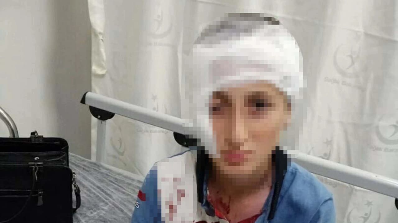 Köpek saldırısında emsal karar: 1,2 milyon TL tazminat cezası
