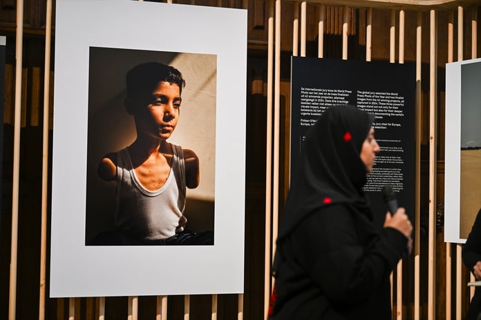 9 yaşındaki Mahmud'un sessiz çığlığı yılın basın fotoğrafı seçildi