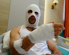 Hediye hazırlığında patlayan sprey boya hastanelik etti