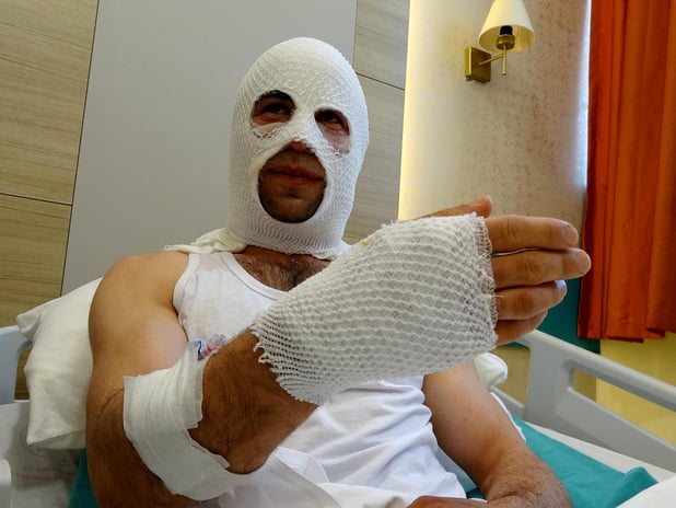 Hediye hazırlığında patlayan sprey boya hastanelik etti