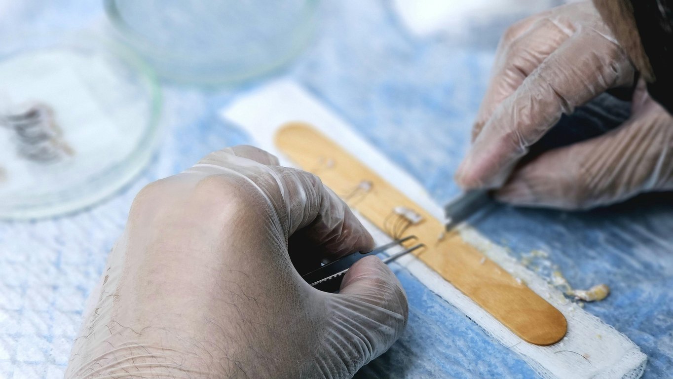 Expert Insights: The Role of Complimentary Hair Transplant Consultations in Achieving Optimal Results