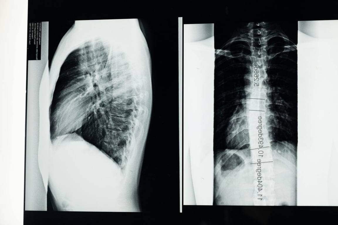 Decoding the Compensation Trends for Radiology Nurses