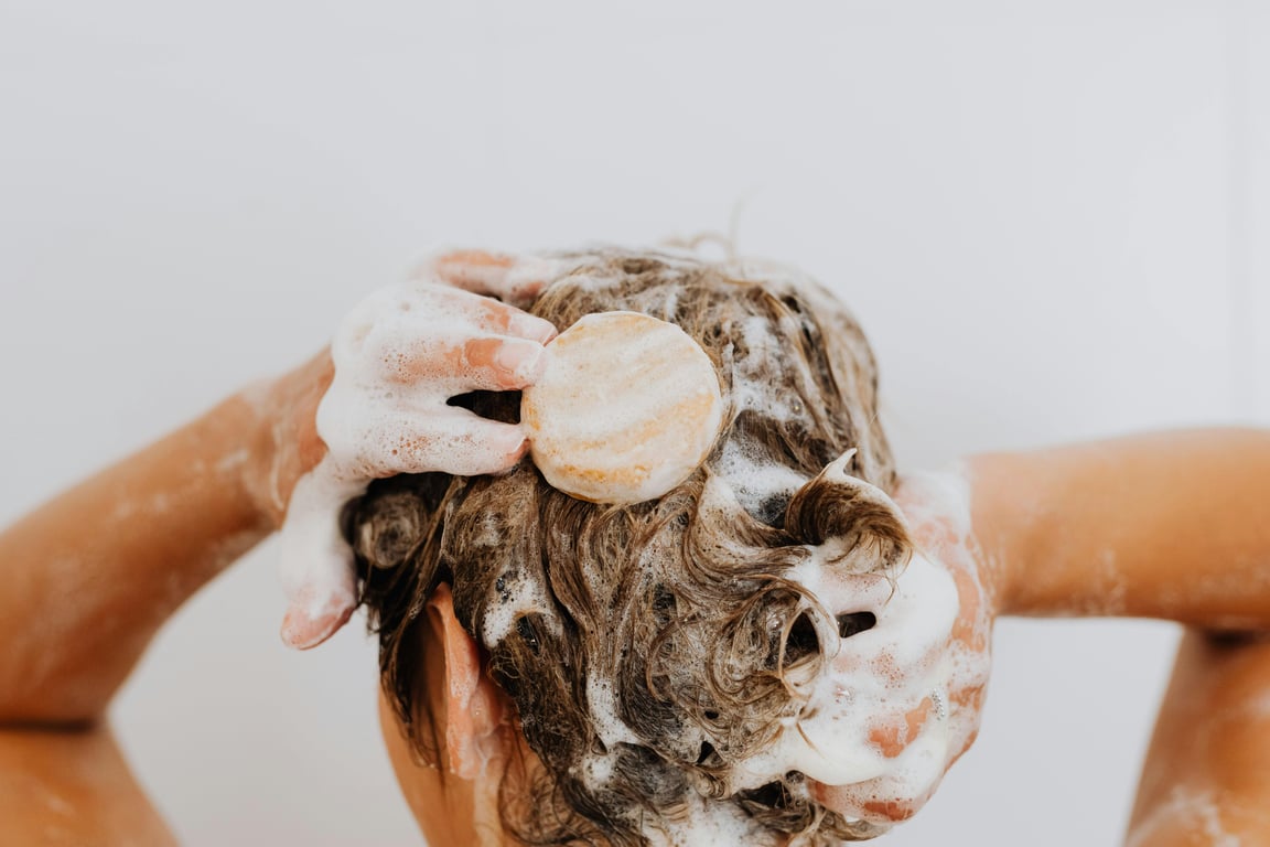 Relieve Scalp Psoriasis Symptoms with Targeted Solutions and Expert Care