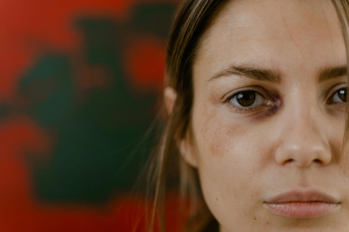 Managing Thyroid Eye Disease Symptoms to Improve Everyday Comfort