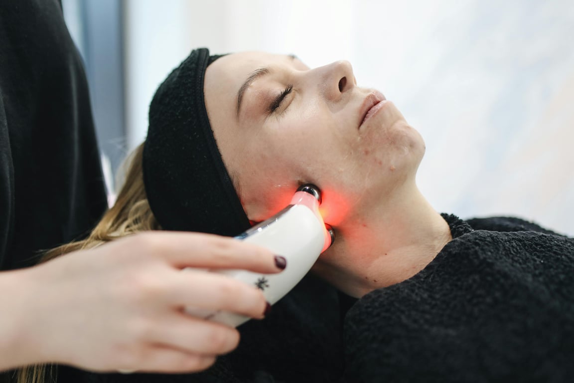 Achieve Radiant Skin Without Breaking the Bank Through Laser Treatments