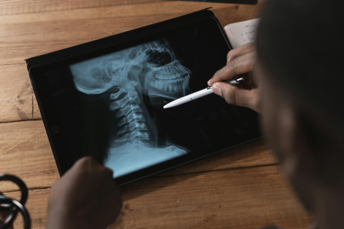 Understanding Spinal Stenosis and Atrophy: Causes, Symptoms, and Treatment Options