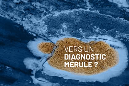 Vers un diagnostic Mérule ?