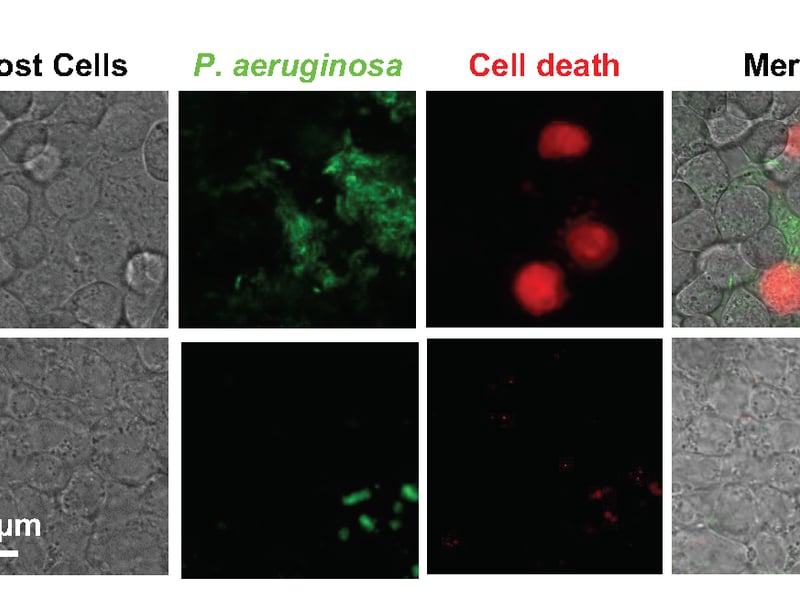 Top: In medium alone, P. aeruginosa (green) attaches to host cells (bright field), triggering cellular rounding and death (red). 
Bottom: The presence of mucin prevents P. aeruginosa from attaching to and killing host cells, thus maintaining a healthy host cell monolayer without rounded morphology.