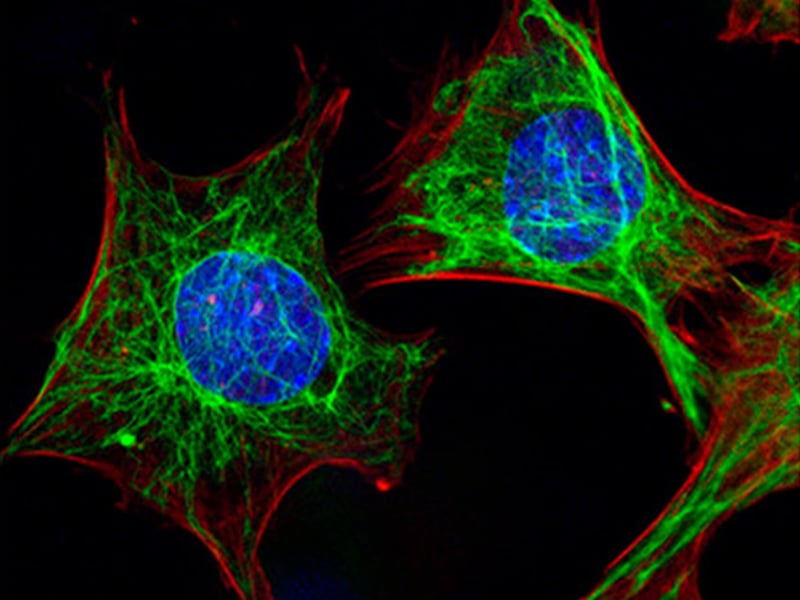 A fluorescent optical micrograph showing how vimentin networks (green) respond to compressive loads, and protect the cell nucleus from mechanical damage