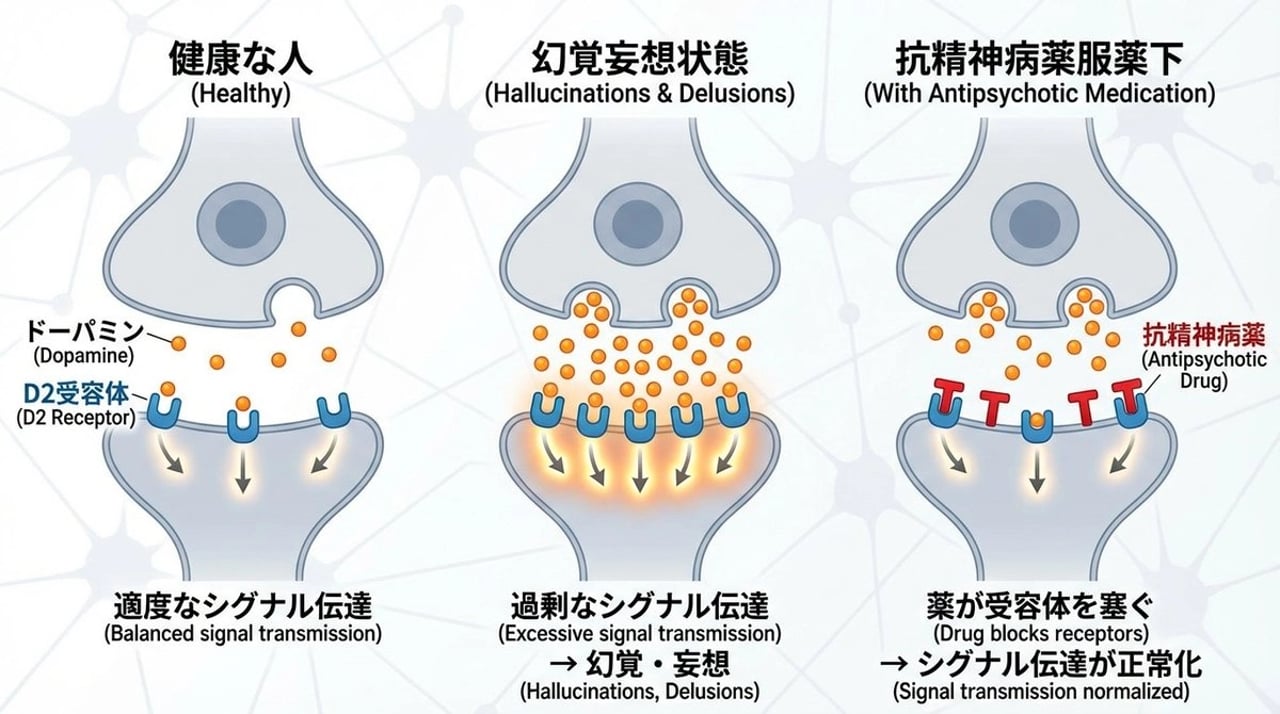 Dopamine and schizophrenia synapse diagram