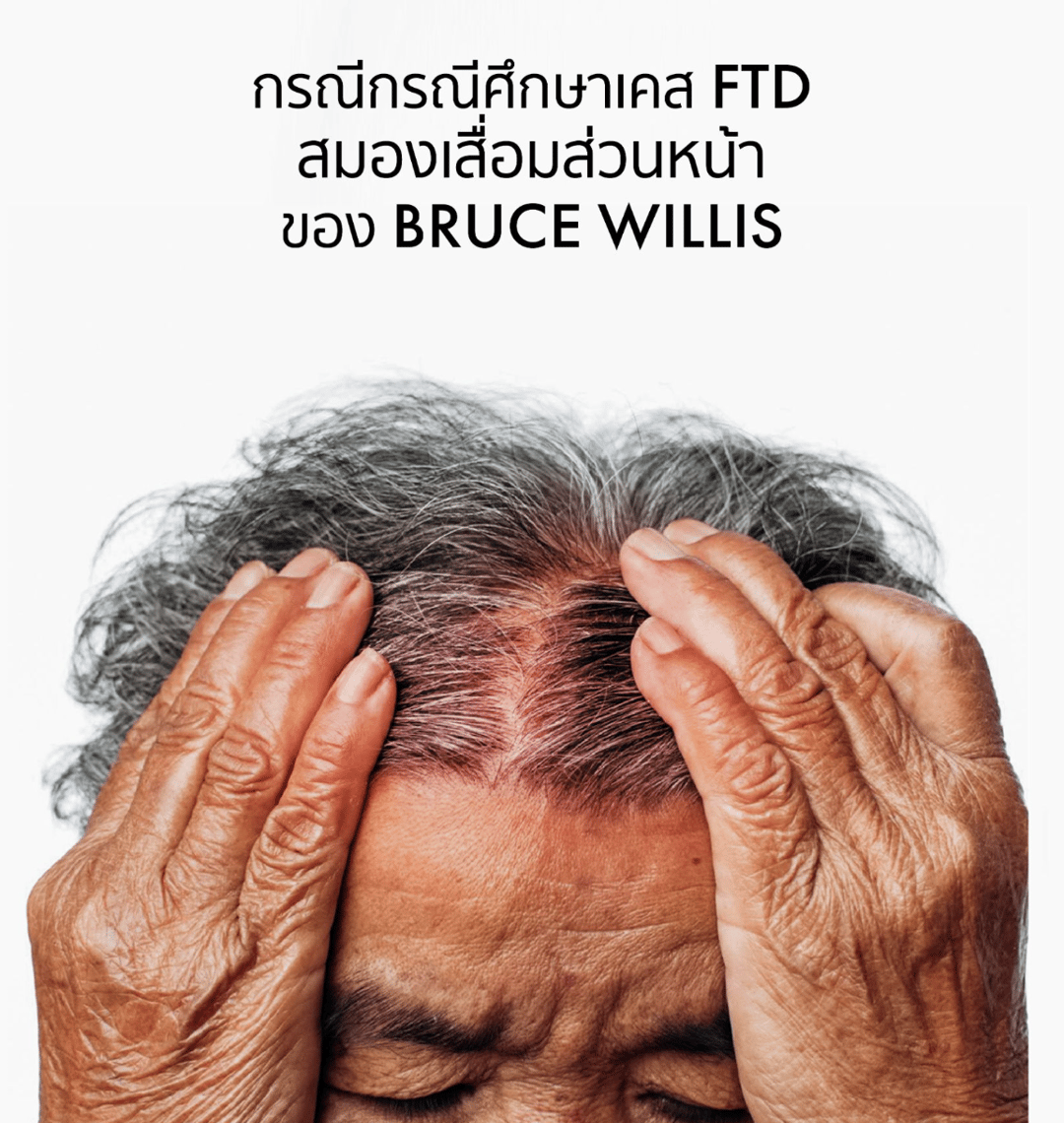 ภาพประกอบบทความกรณีศึกษาภาวะสมองเสื่อมส่วนหน้า