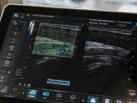 Ultrasound elastography of soft tissue on a clinic scanner