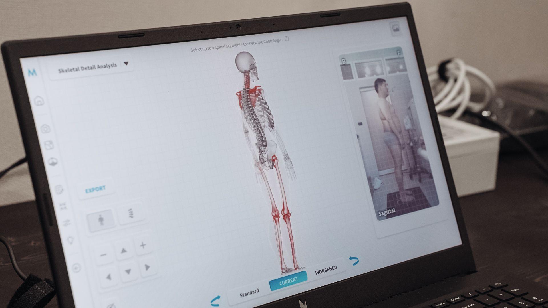 Holistic body analysis being carried out at PYONG Rehabilitation