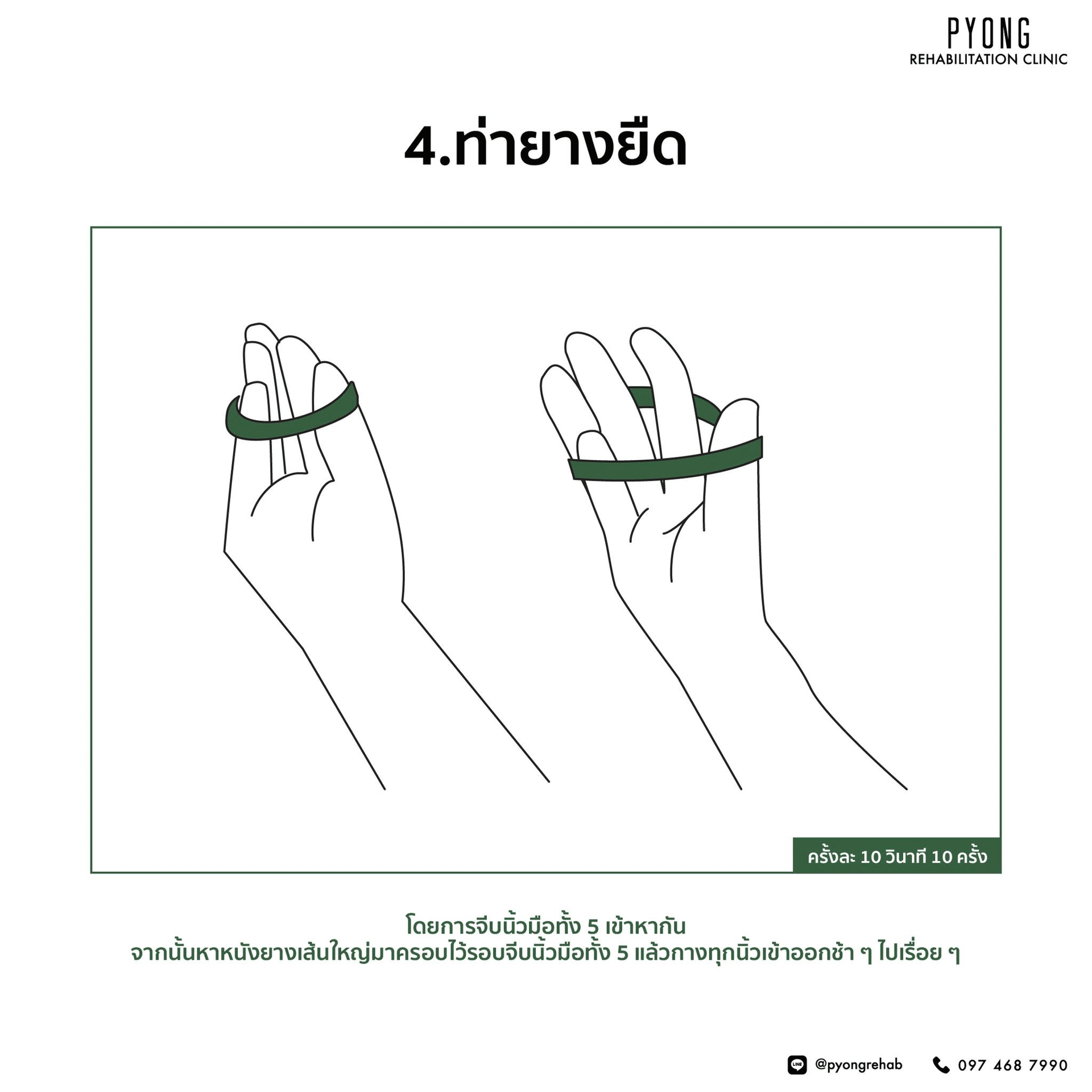 ภาพสาธิตท่าฝึกนิ้วด้วยหนังยางคล้องรอบปลายนิ้วทั้งห้า