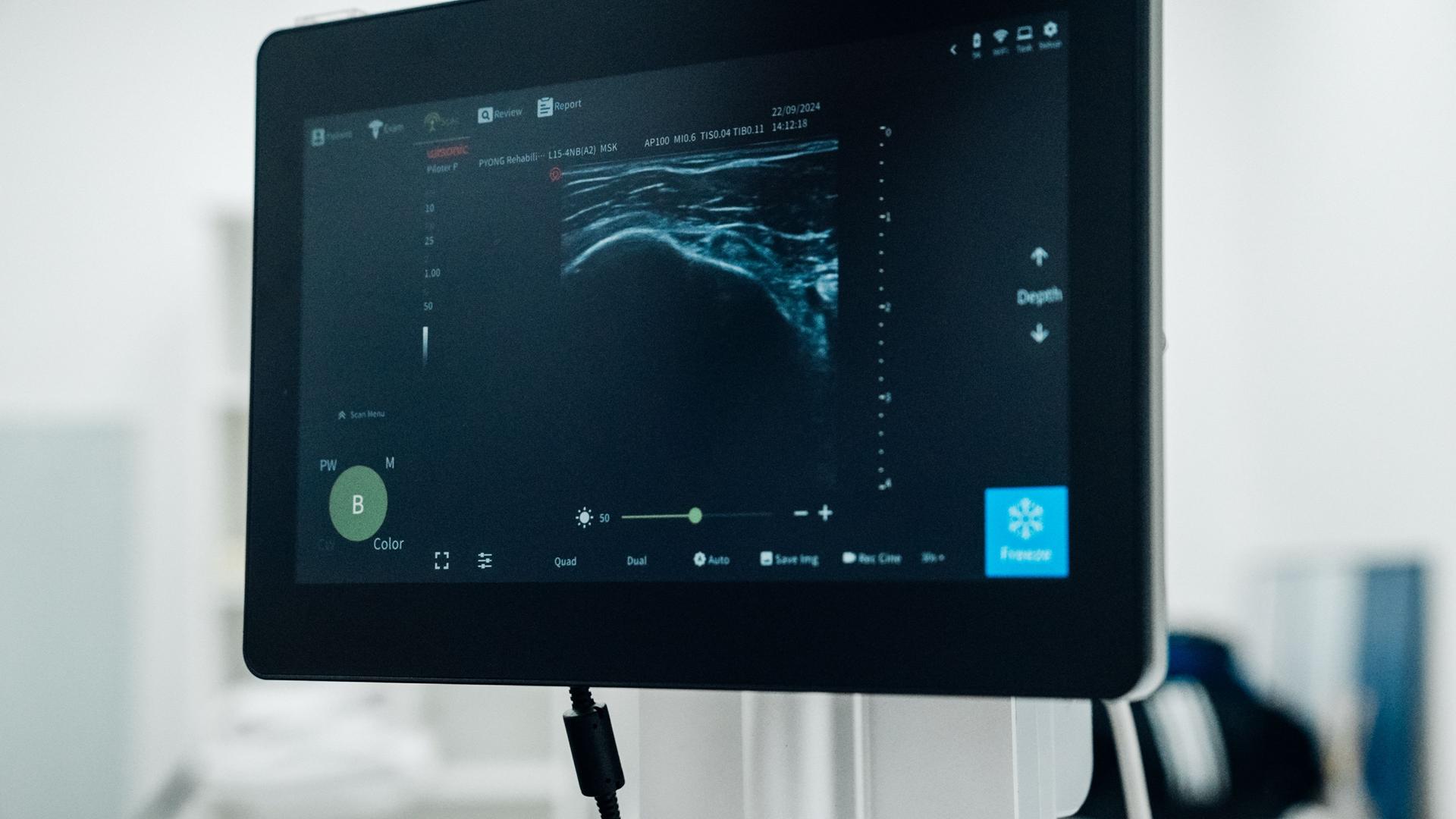 Ultrasound MSK1