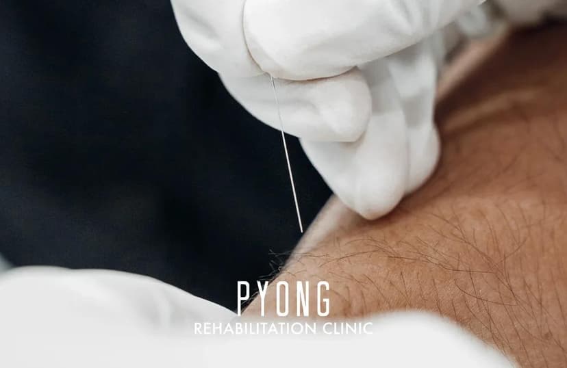 ปักเข็มแพทย์แผนตะวันตก (Dry Needling)