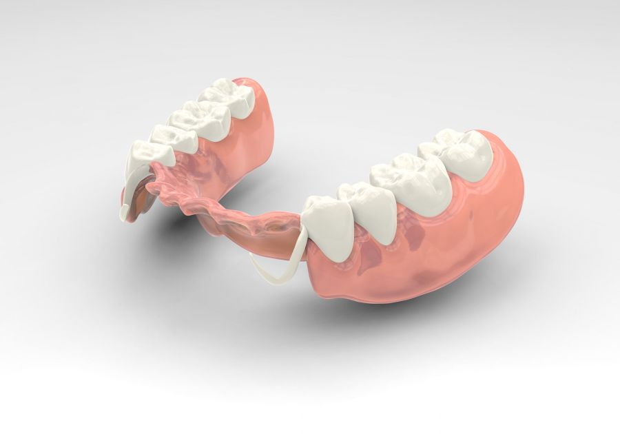 Partial dentures
