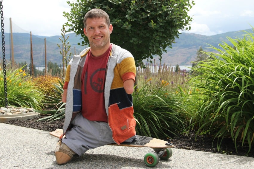 <who> Photo Credit: KelownaNow.com </who> Chris Koch was born without any arms and legs, but that hasn't stopped him from taking over the world.