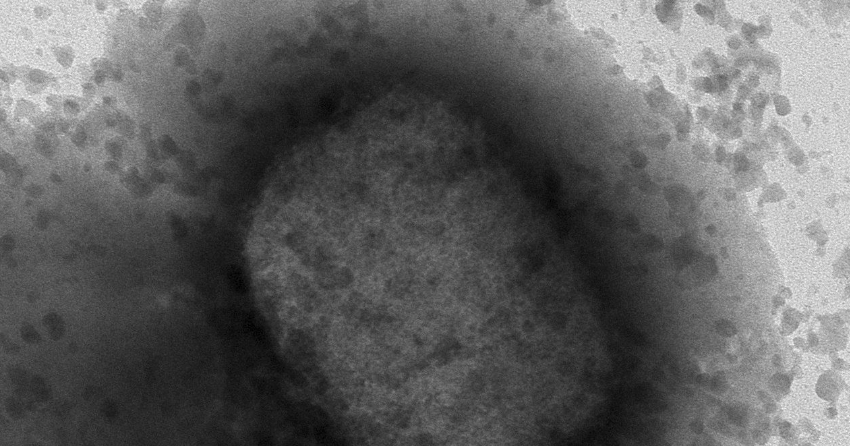 168 cases of monkeypox confirmed in Canada