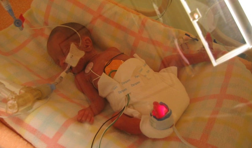 <who> Photo Credit: Megan Walker </who> Emma in the incubator at BC Children's Hospital in 2004.