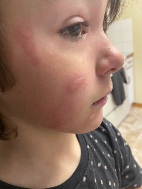 </who>Photo credit: Oasiss Facebook | S. Summerfield