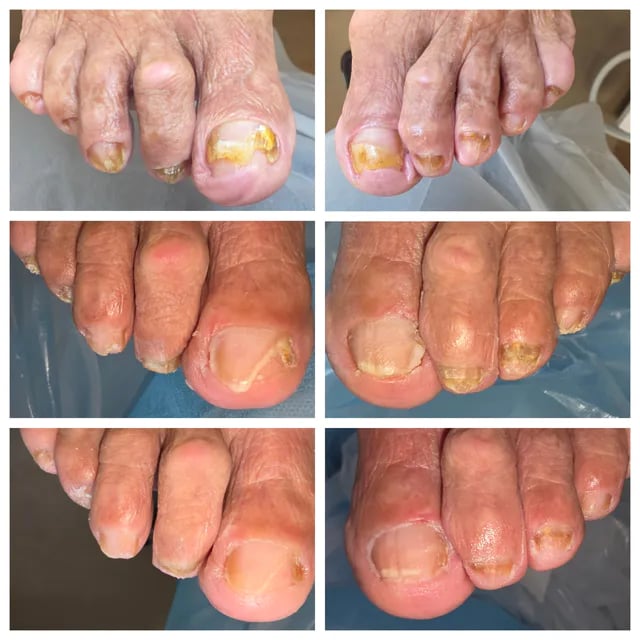 Professional Pedicure Clinic