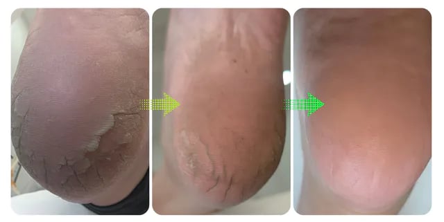 Professional Pedicure Clinic