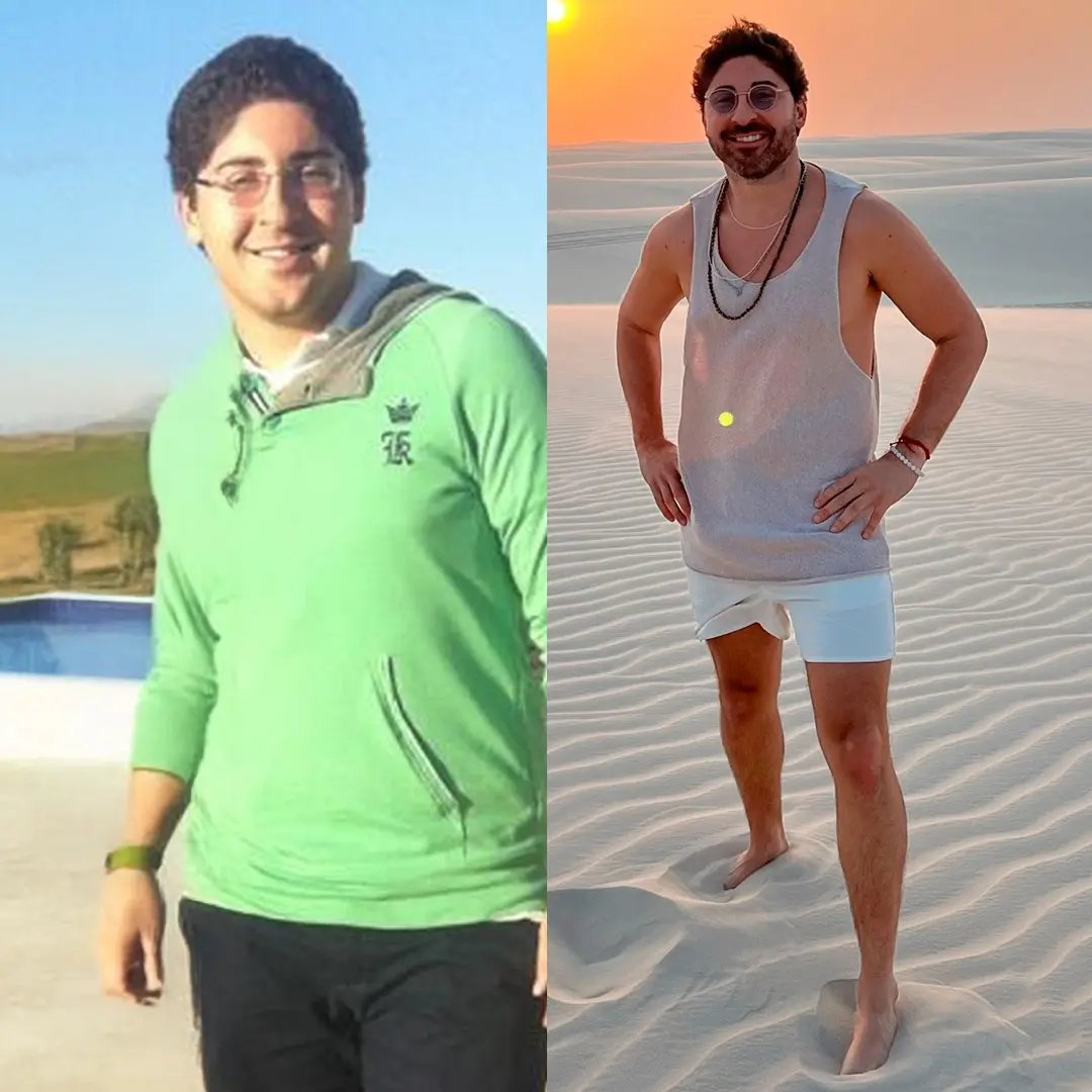 Foto de antes e depois de Felipe Caputo