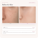 K-Beauty Starter Routine