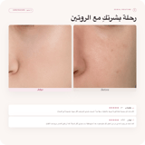 روتين كي-بيوتي للمبتدئات